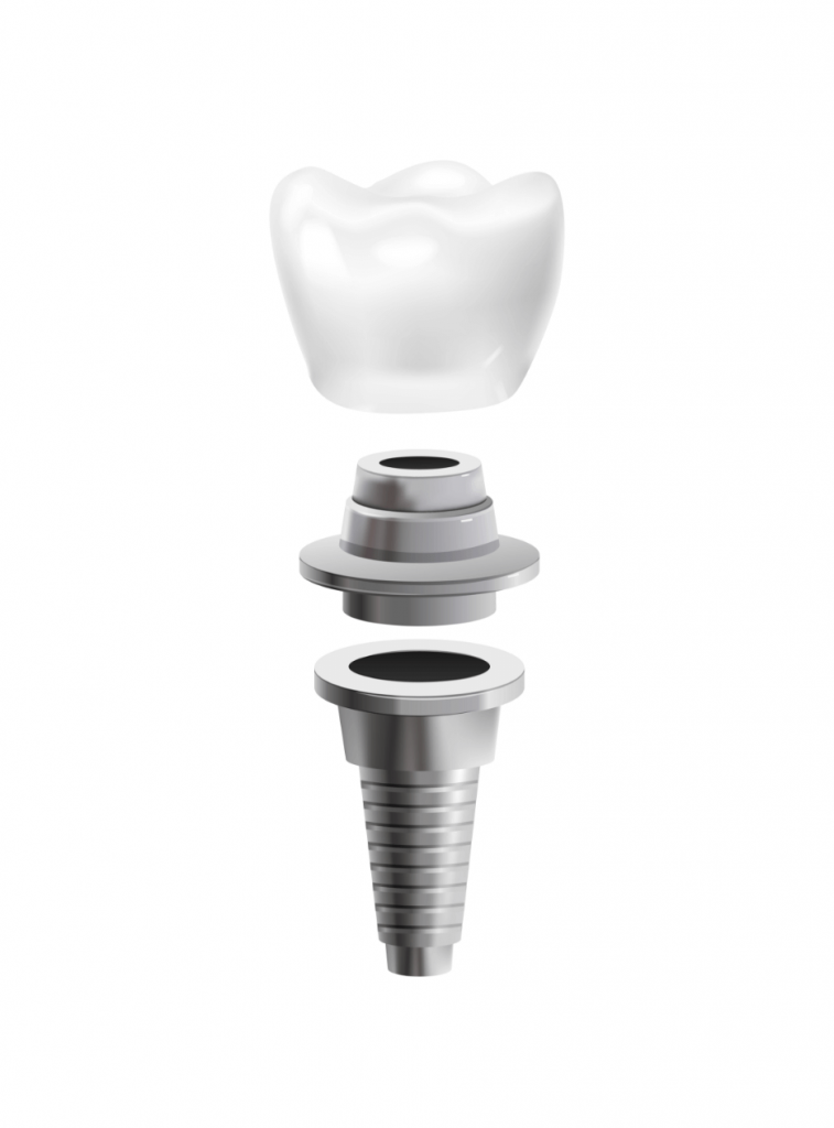 Wisdom teeth and third molars anatomy