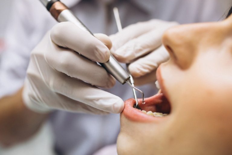 Close-up of mercury amalgam fillings before safe removal
