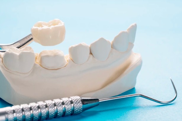 Porcelain and zirconia dental crowns