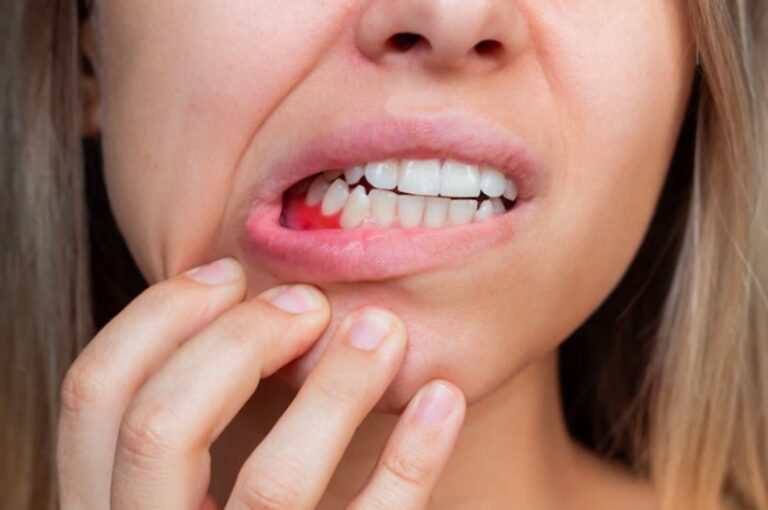 Laser treatment for gum disease at Mint Dental Care