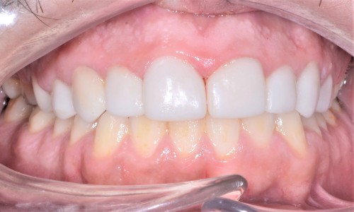 Digital Smile Design