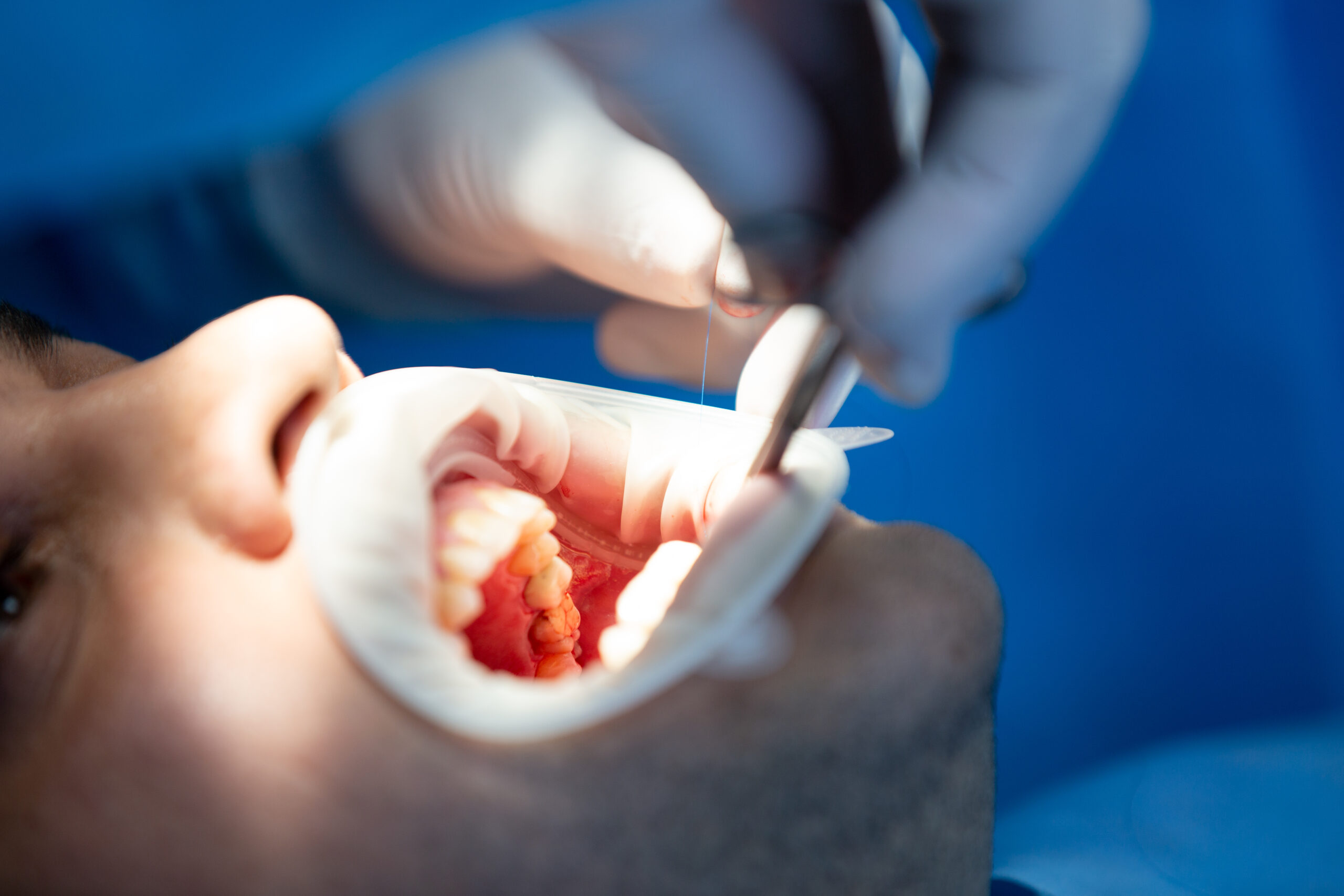 Dental treatment at Mint Dental Care