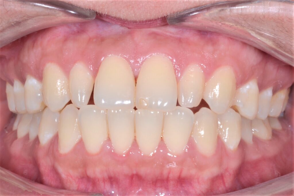 Shela before treatment