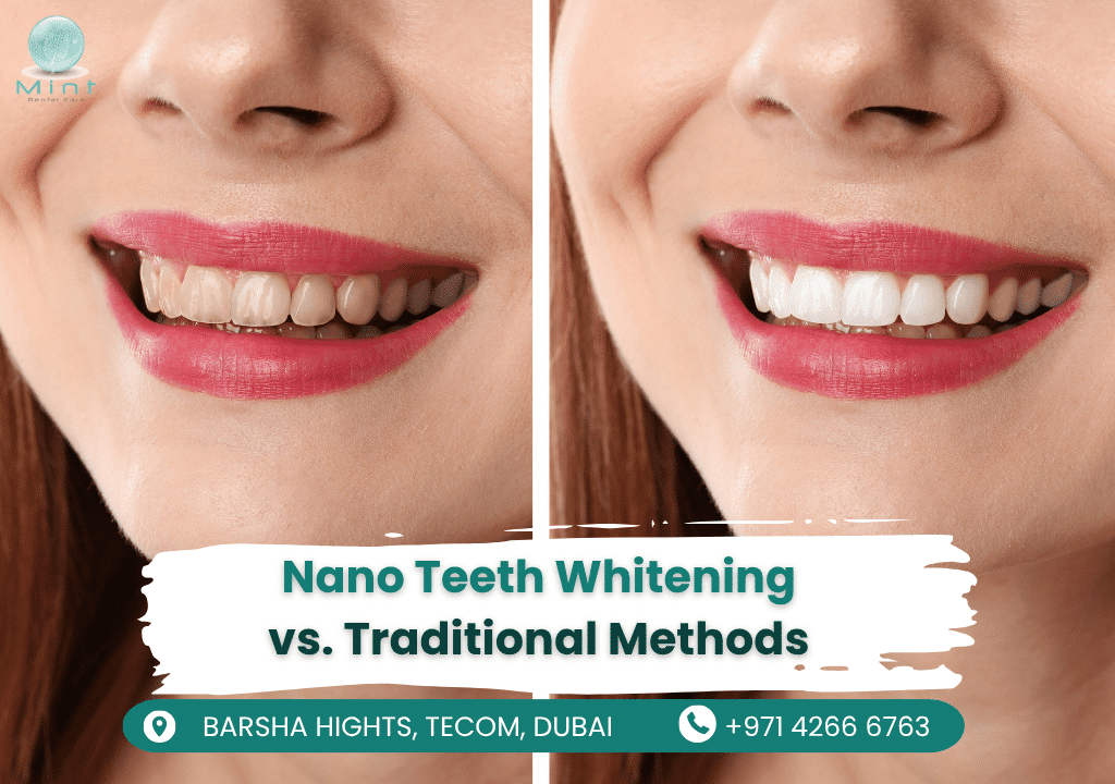 Side-by-side comparison of Nano Teeth Whitening (left) and traditional whitening (right), showing how nanoparticles penetrate enamel vs.