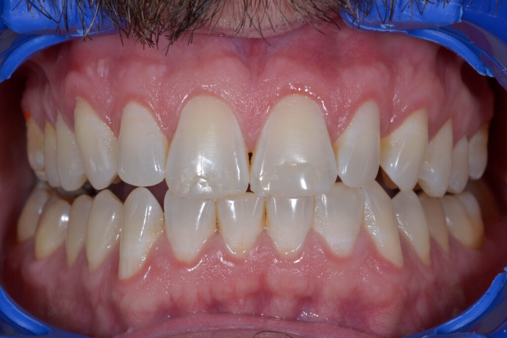 Sam before treatment
