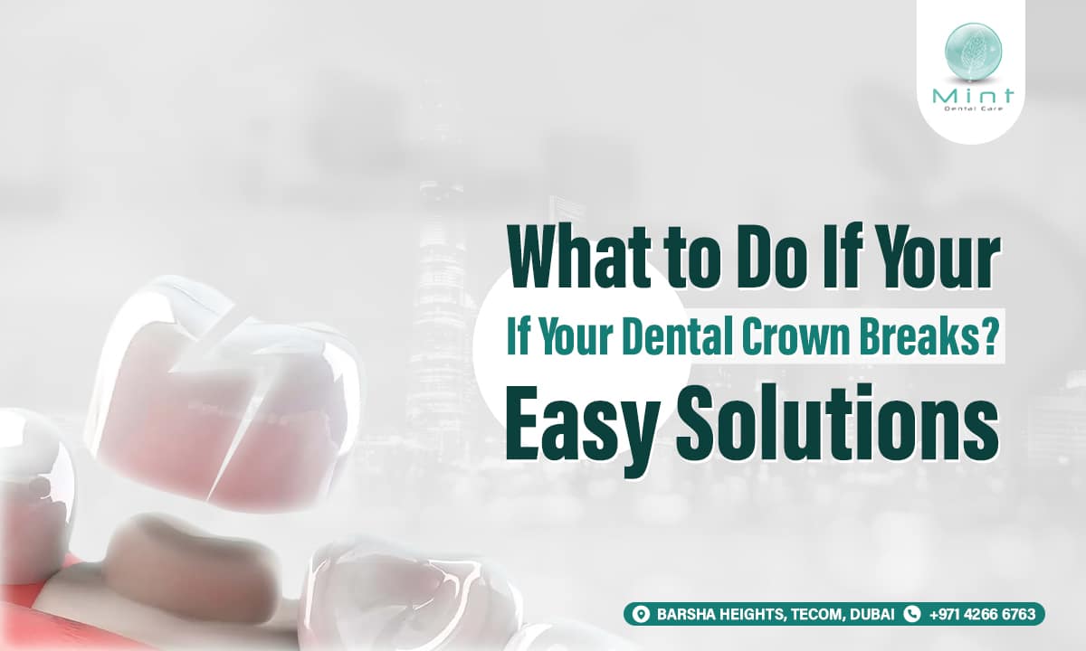 What to Do If Your Dental Crown Breaks? Easy Solutions