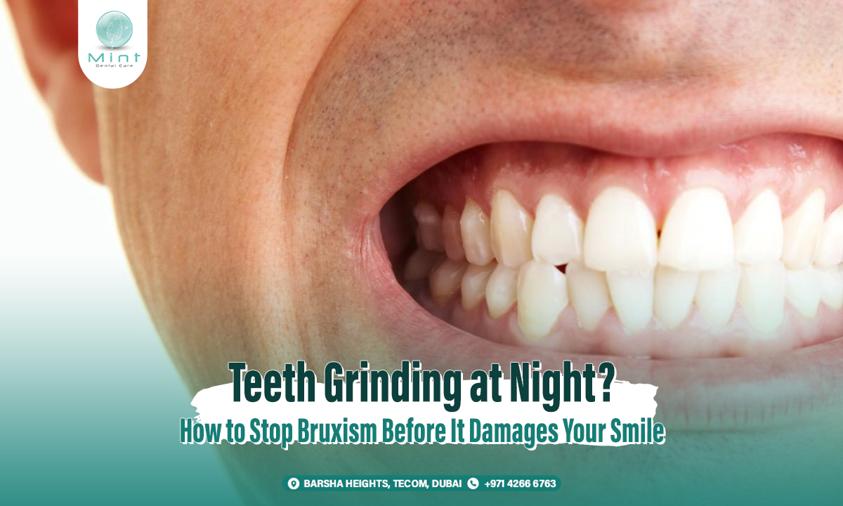 Teeth Grinding at Night? How to Stop Bruxism Before It Damages Your Smile