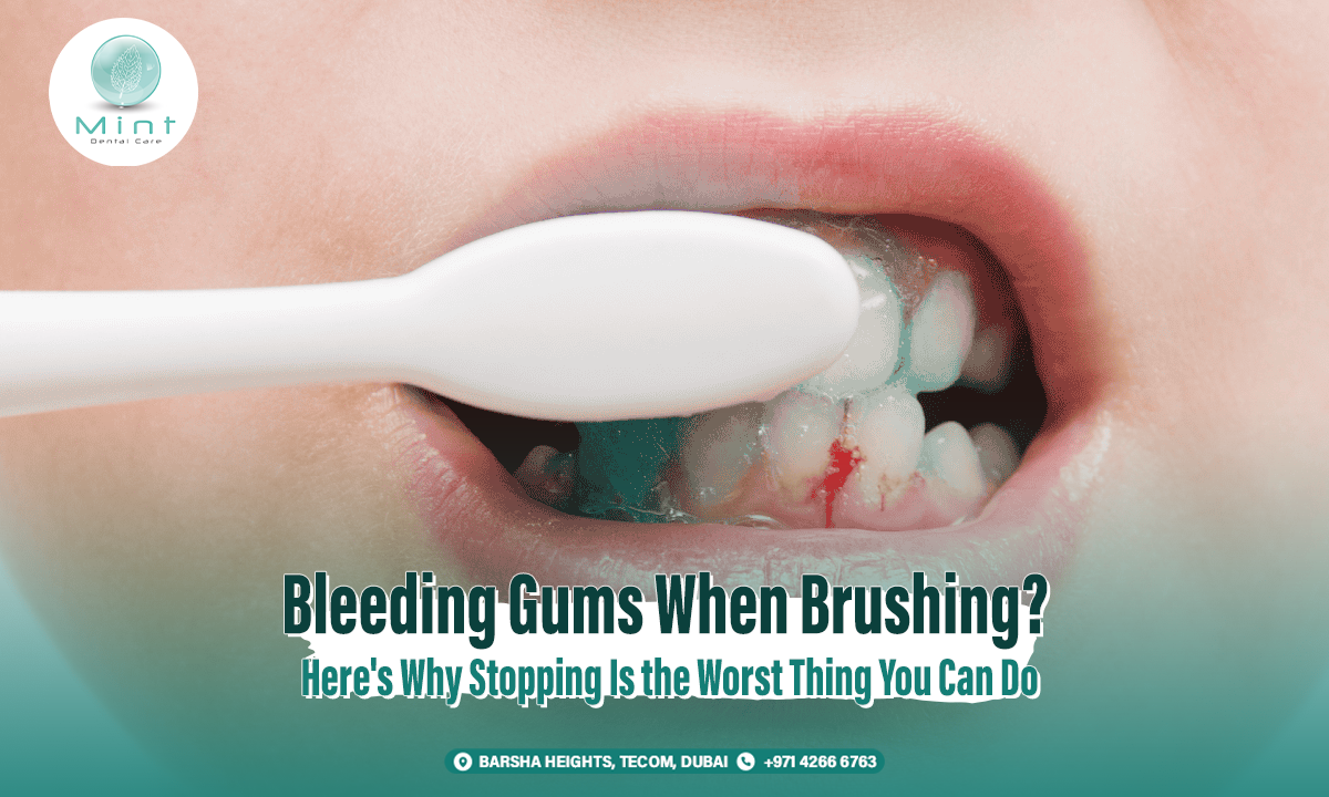 Bleeding Gums When Brushing? Here&#8217;s Why Stopping Is the Worst Thing You Can Do