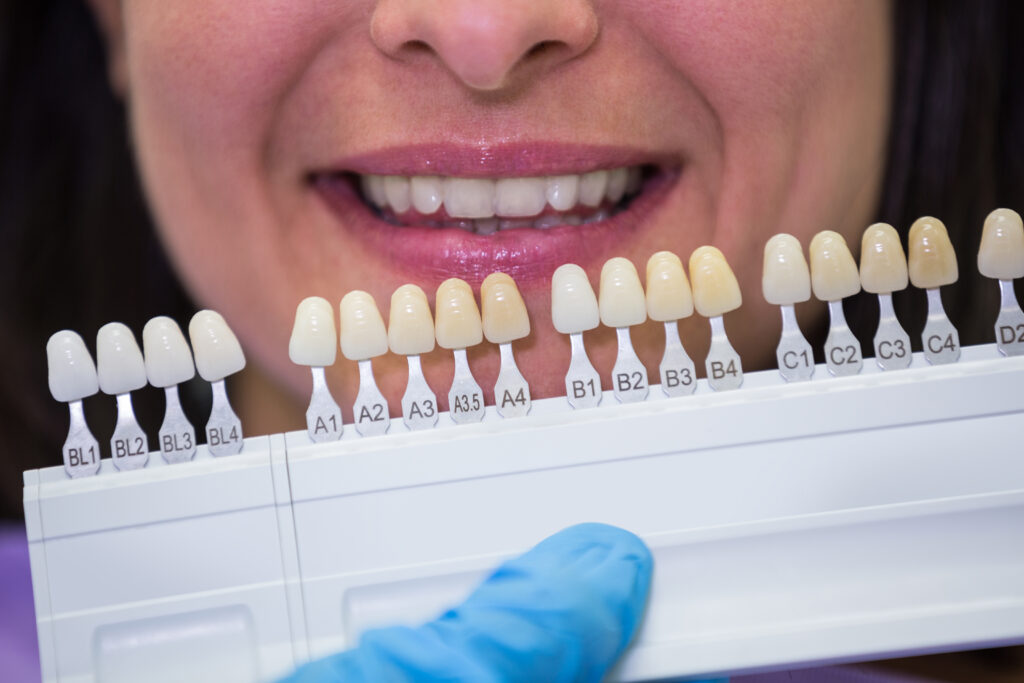 Dentist checking teeth shade after cleaning at Mint Dental Care