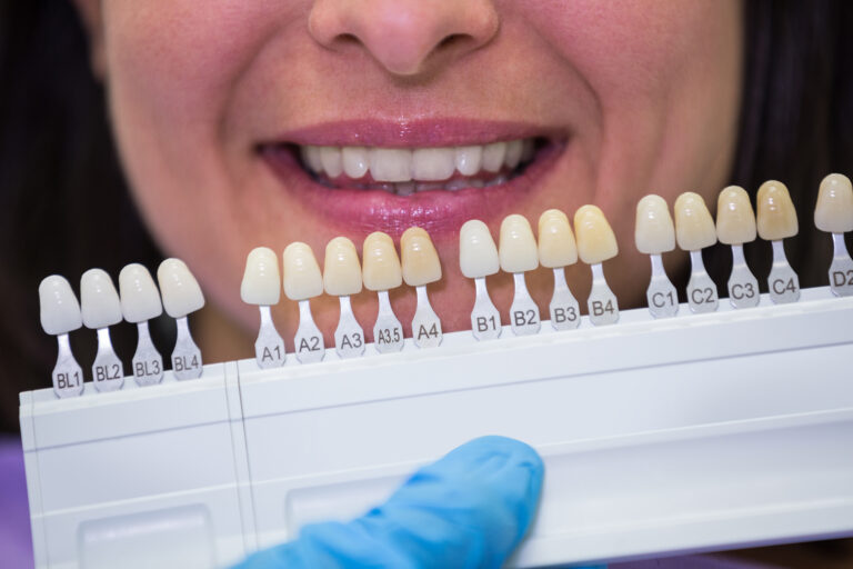 Smart Amalgam Removal