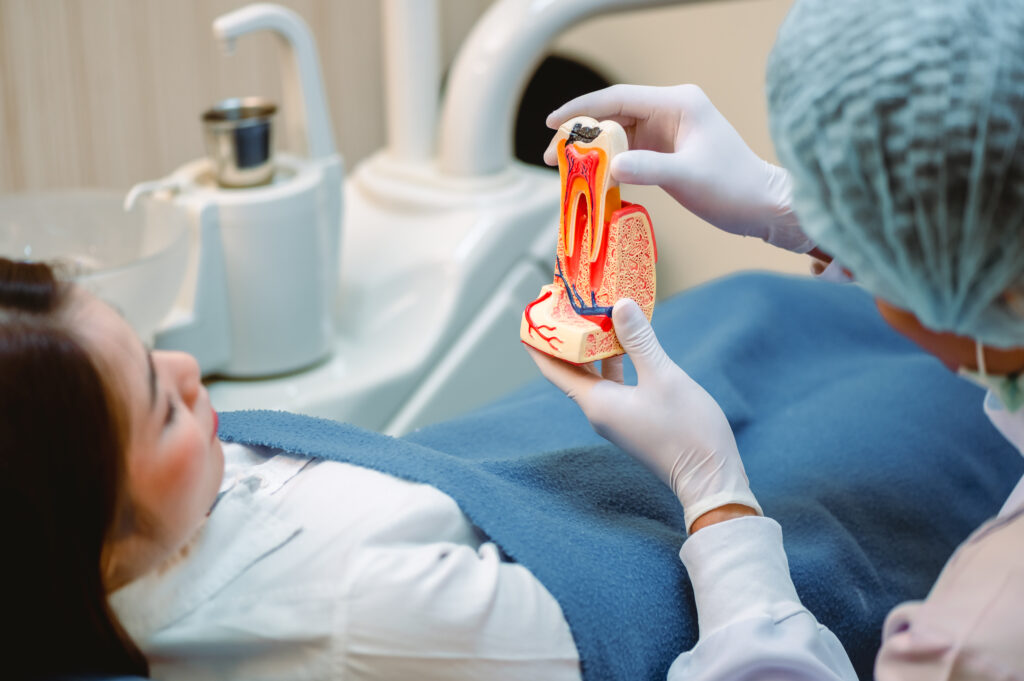 Fillings & Root Canal