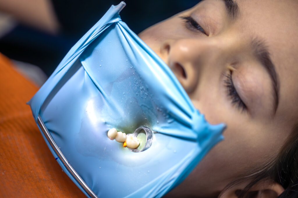 Child receiving gentle dental treatment at Mint Dental Care