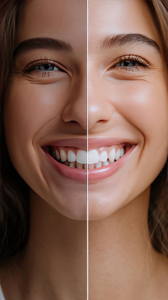 What Causes Tooth Discoloration?