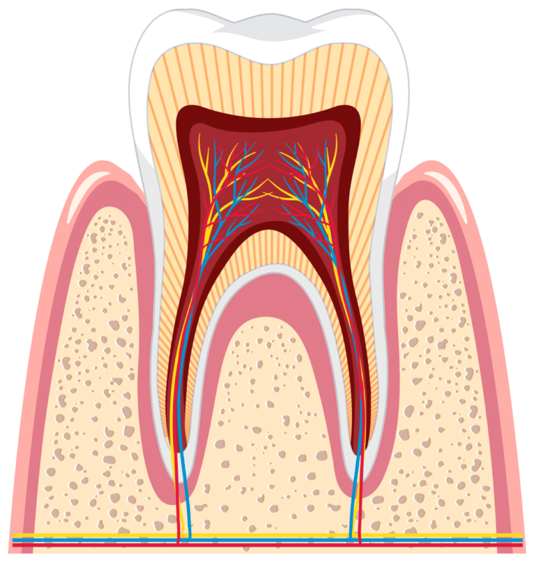 علاج عصب الأسنان في Mint Dental Care