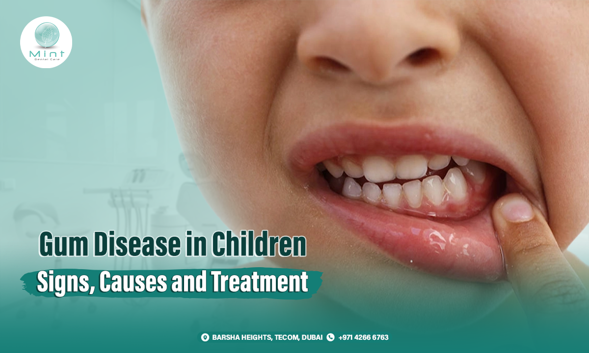 Mint Dentals Dubai