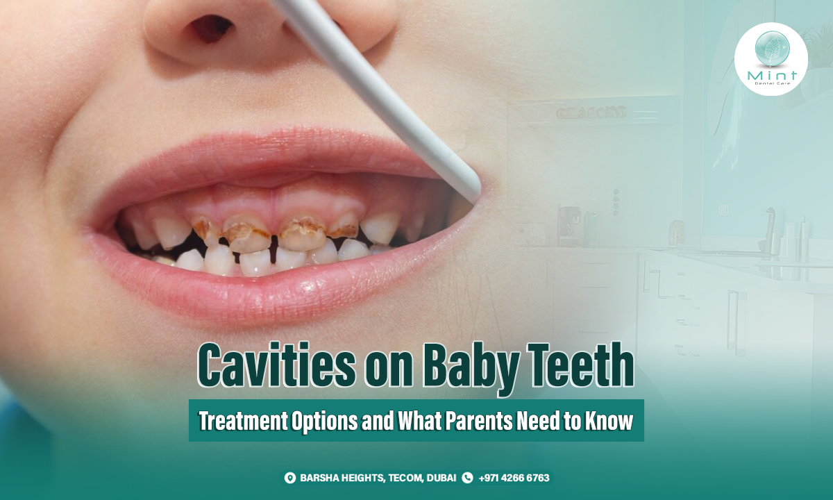 cavities baby teeth treatment