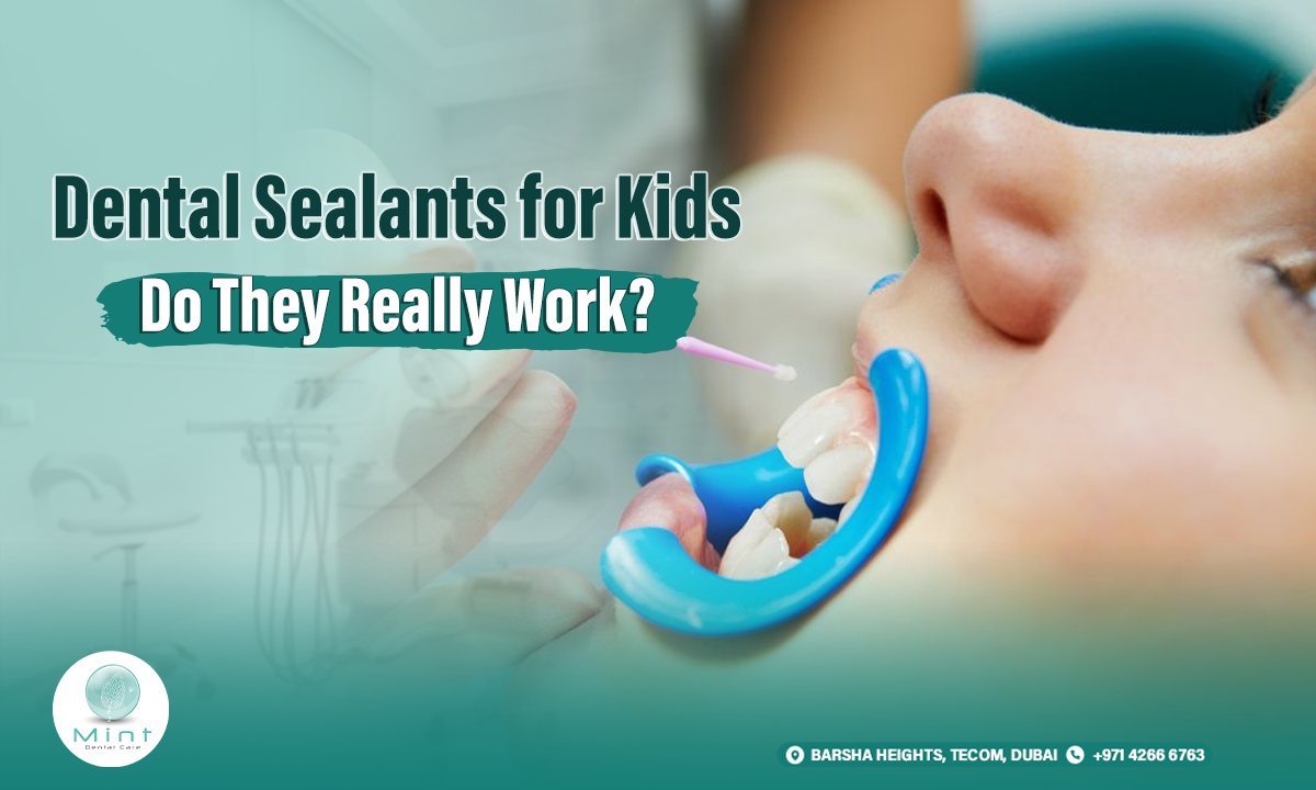 dental sealants for kids