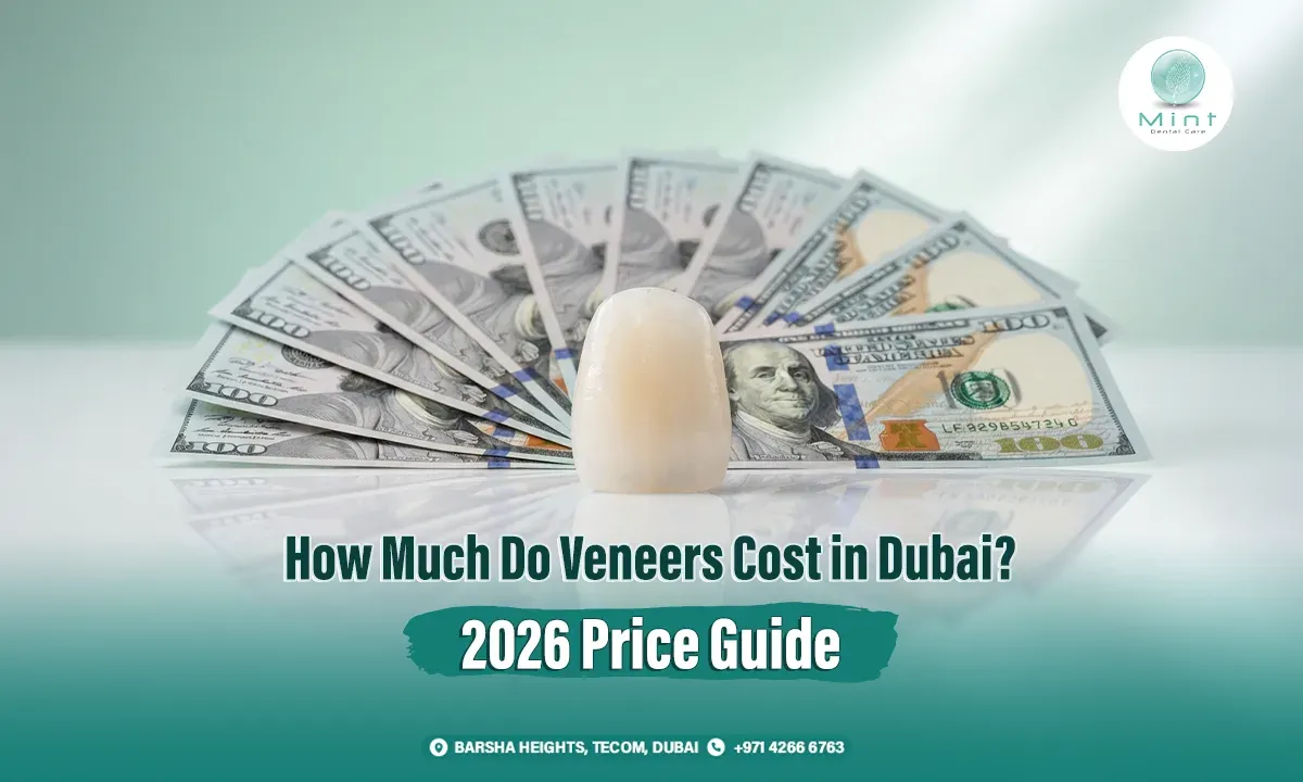 veneers cost in dubai