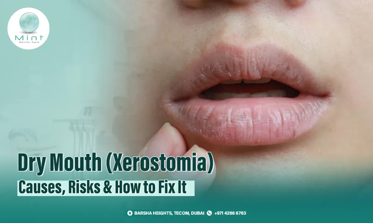 Dry Mouth (Xerostomia): Causes, Risks &#038; How to Fix It