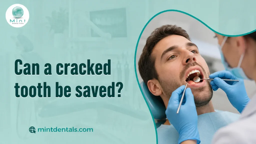 Can a cracked tooth be saved