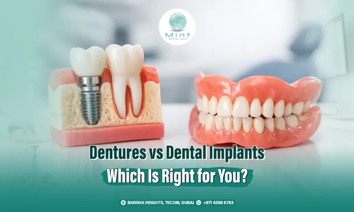 Dentures vs dental implants comparison — Mint Dental Care Dubai
