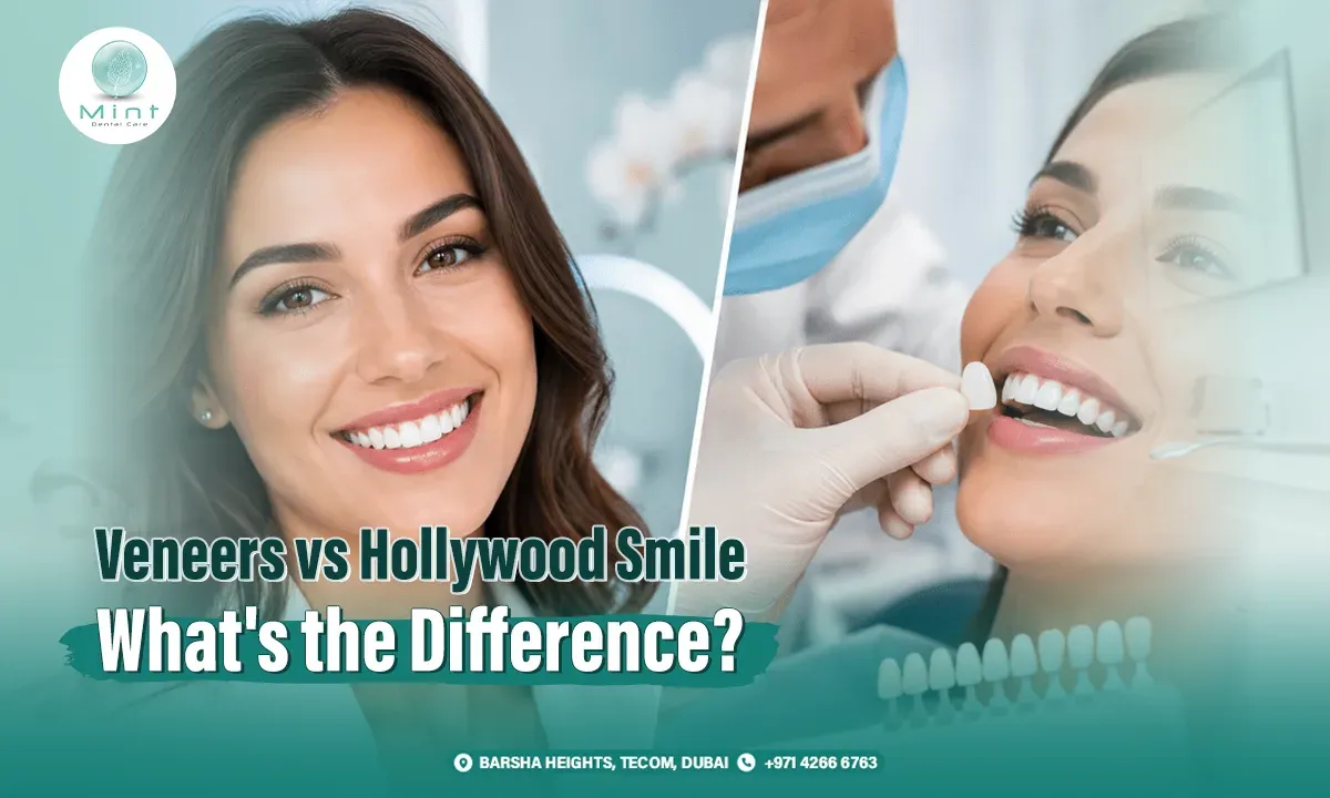 Veneers vs Hollywood Smile: What&#8217;s the Difference?