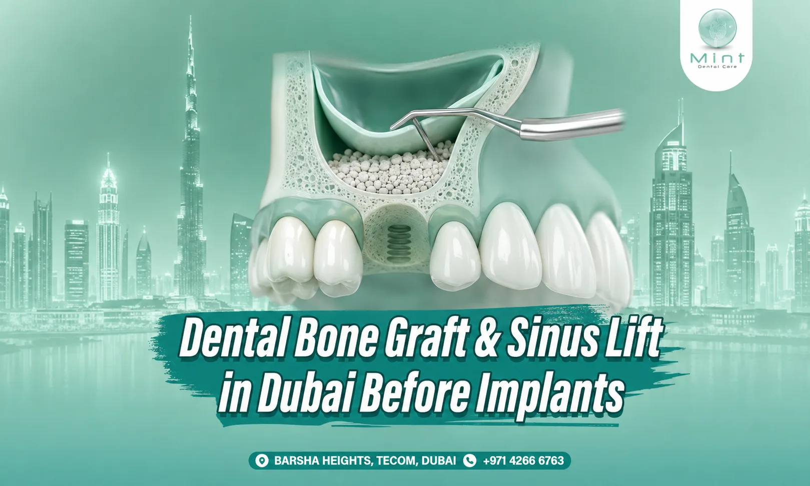 dental bone graft