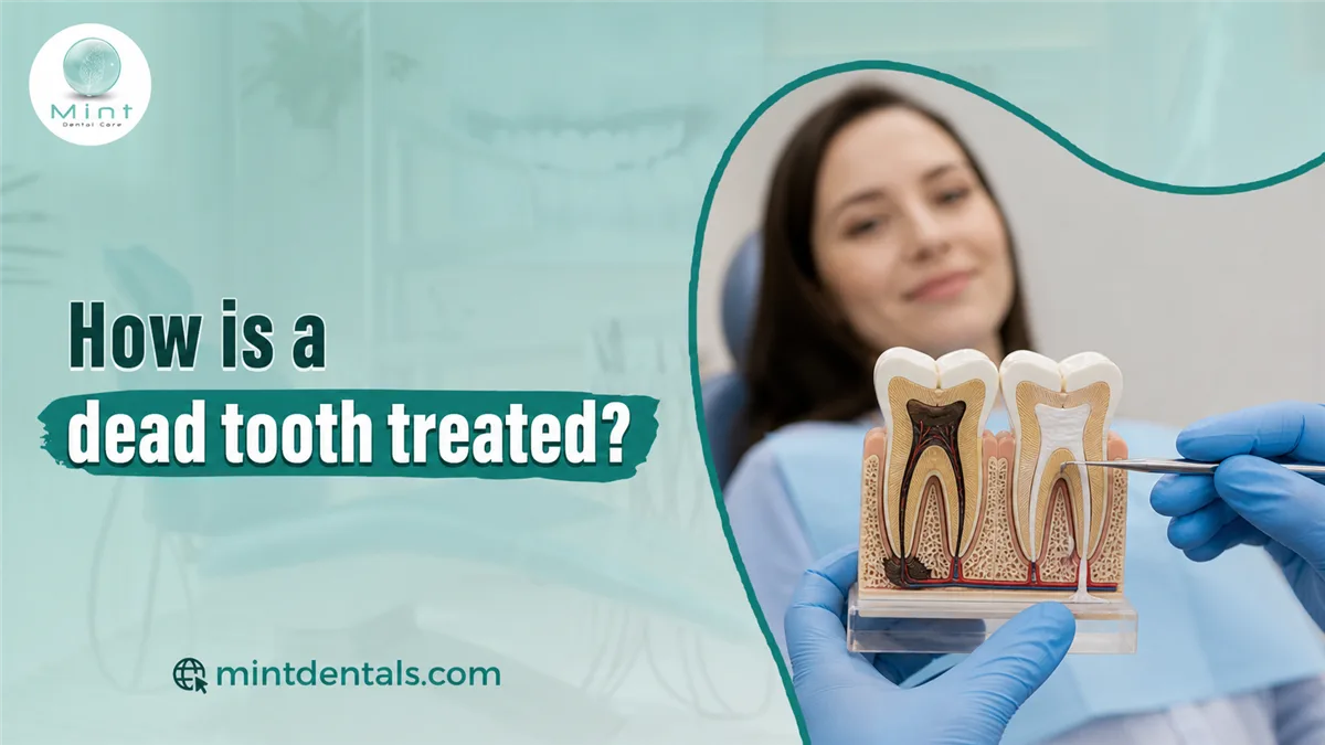 How is a dead tooth treated?