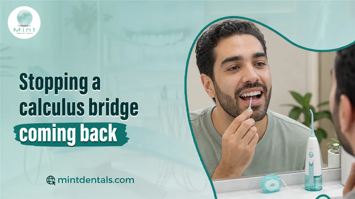 Stopping a calculus bridge coming back