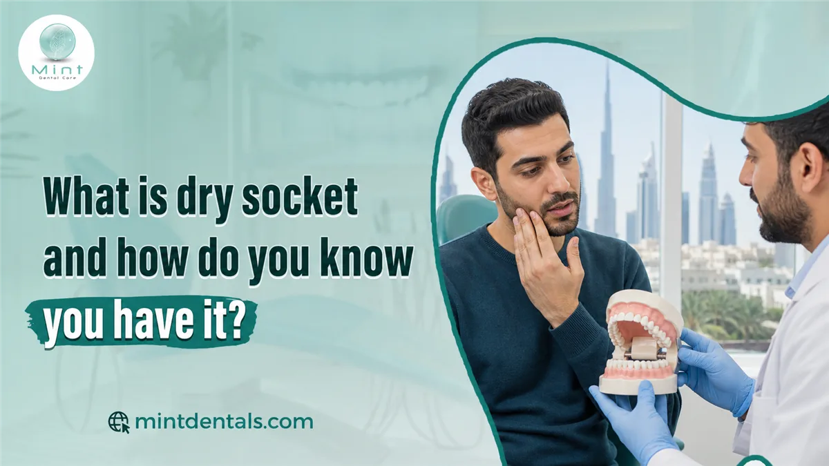 What is dry socket and how do you know you have it?