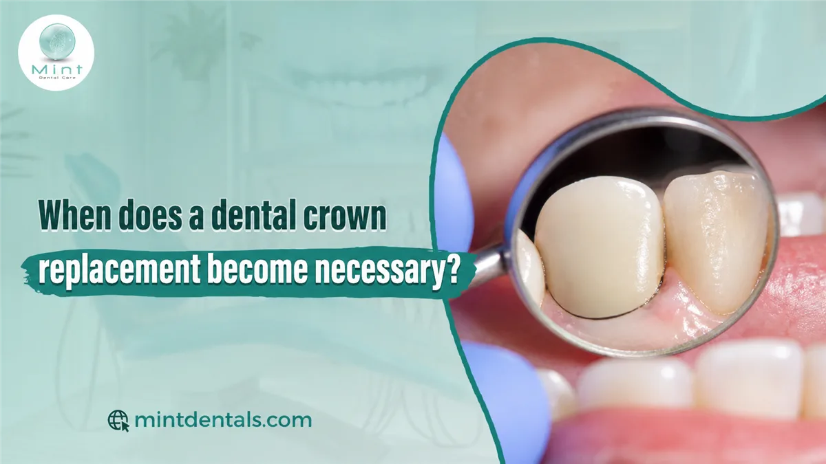 When does a dental crown replacement become necessary?