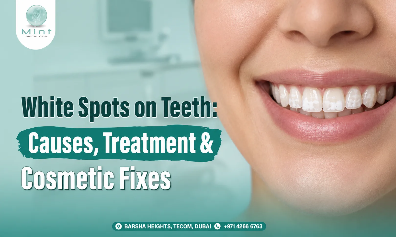 white spots on teeth