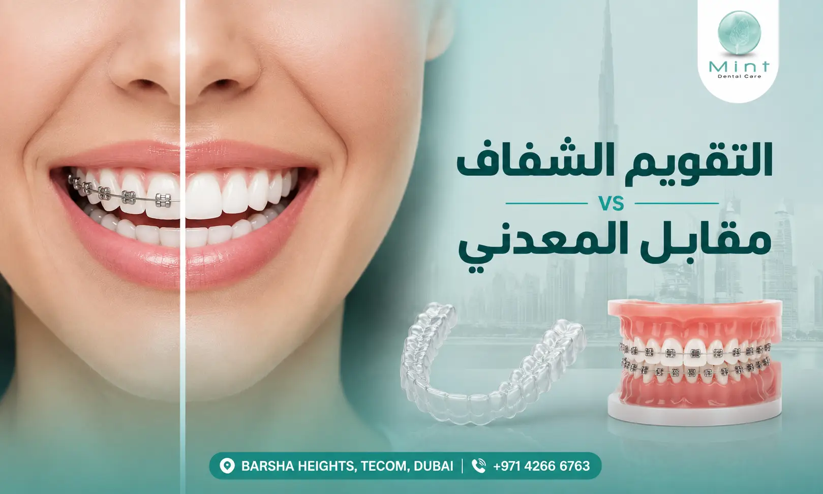 تقويم أسنان شفاف مقابل التقويم المعدني مع مقارنة بين القوالب الشفافة والتقويم التقليدي على الأسنان.