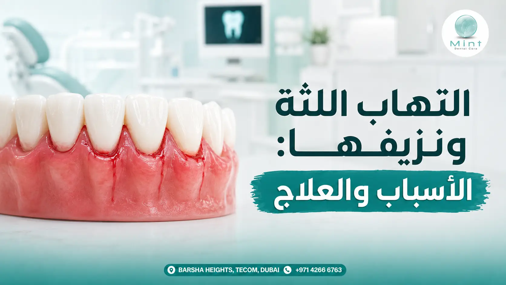 التهاب اللثة ونزيفها مع توضيح احمرار ونزيف اللثة حول الأسنان وطرق العلاج.