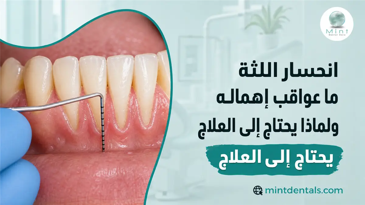 انحسار اللثة ما عواقب إهماله ولماذا يحتاج إلى العلاج