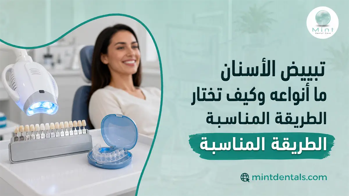 تبييض الأسنان مع جهاز التبييض ودرجات لون الأسنان وقالب شفاف لتوضيح أنواع التبييض وكيفية اختيار