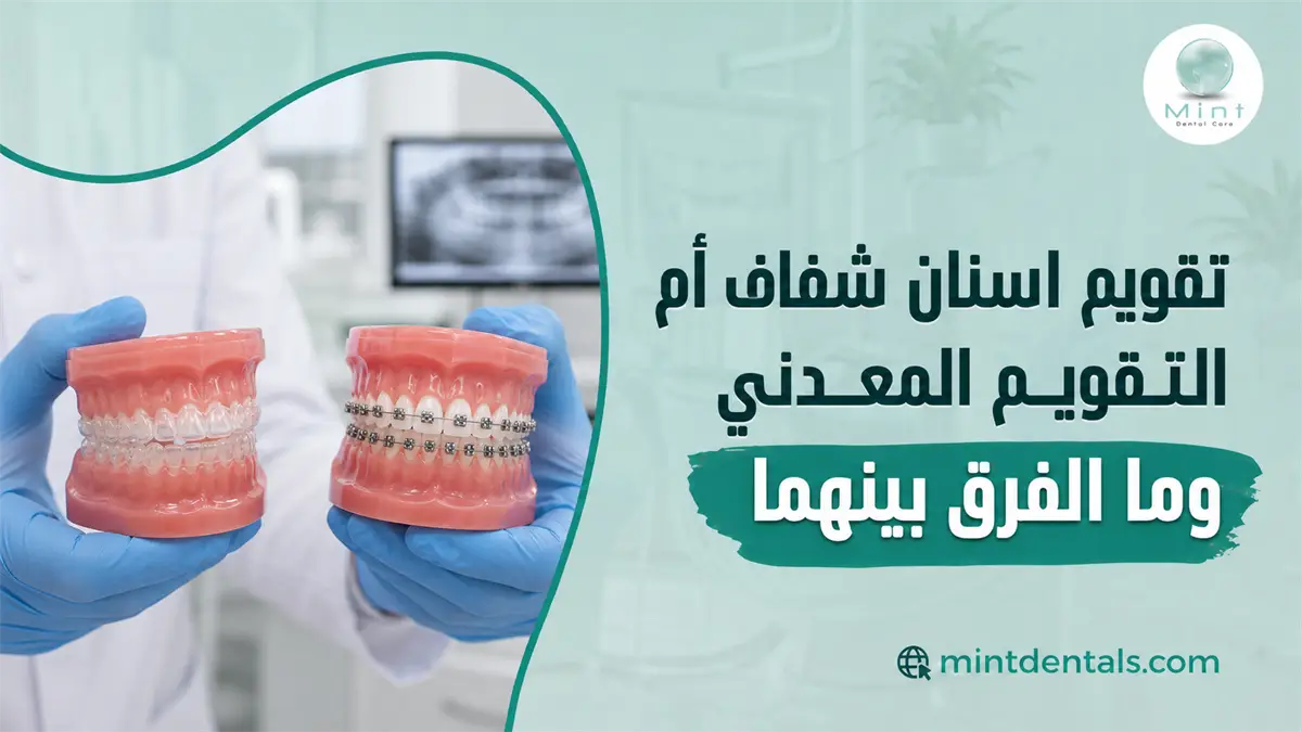 تقويم اسنان شفاف أم التقويم المعدني وما الفرق بينهما