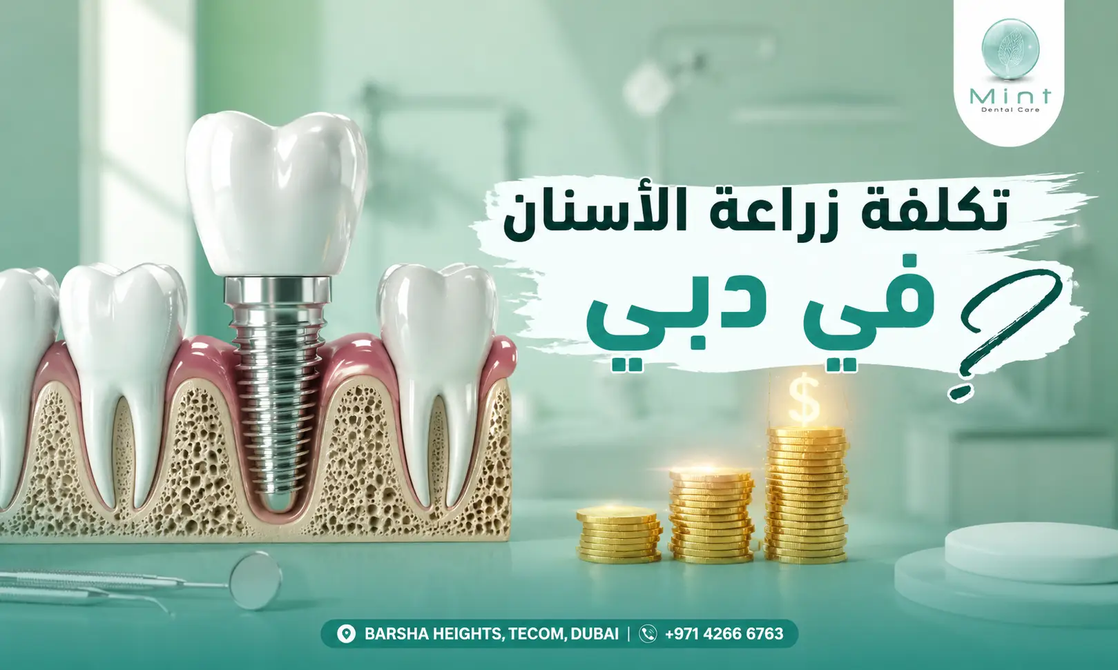 زراعة الأسنان في دبي مع نموذج لزرعة سنية داخل عظم الفك وتوضيح العوامل التي تحدد خطة العلاج.