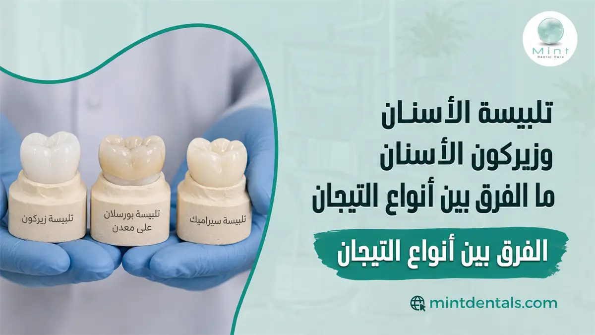 تلبيسة الأسنان وزيركون الأسنان ما الفرق بين أنواع التيجان