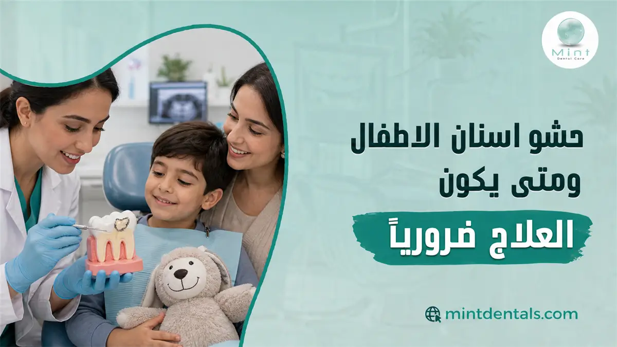 حشو أسنان الأطفال مع طبيبة تشرح للطفل ووالدته علاج تسوس الأسنان ومتى يصبح الحشو ضروريا.