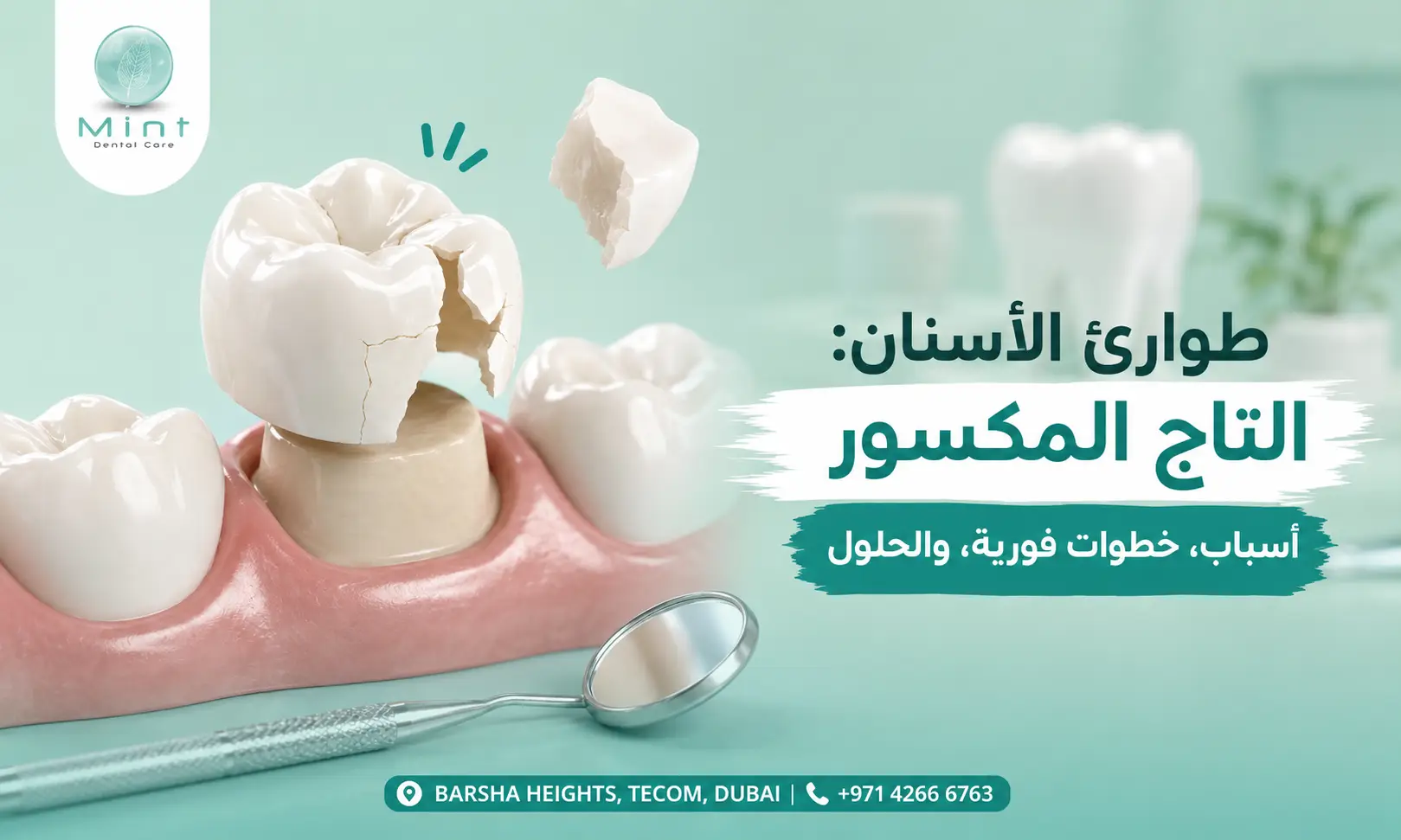 طوارئ أسنان دبي مع تاج أسنان مكسور وتوضيح الأسباب والخطوات الفورية والحلول المناسبة للحفاظ على السن.