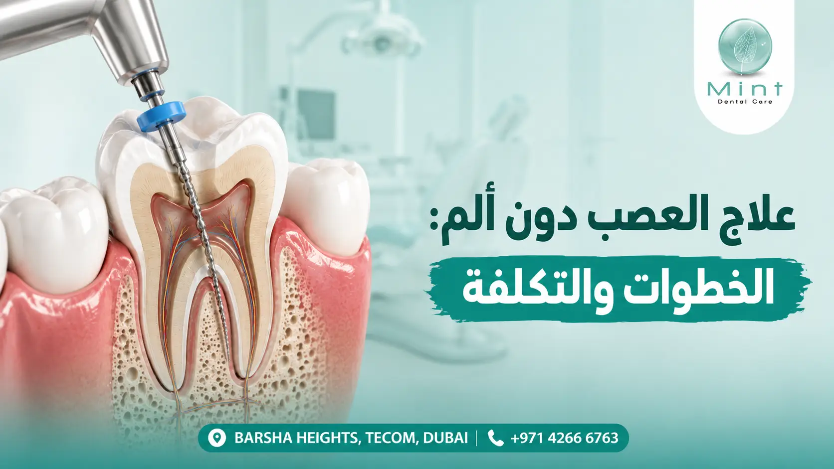 علاج عصب السن دون ألم مع توضيح تنظيف قنوات الجذر داخل السن وخطوات علاج العصب في عيادة الأسنان.