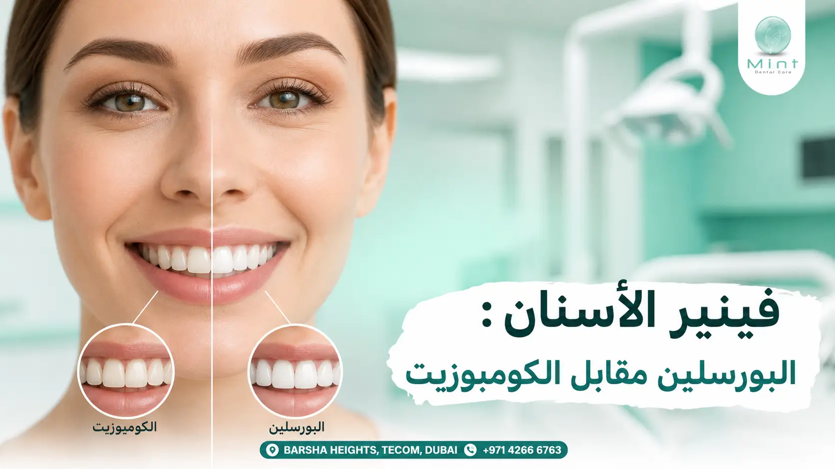 فينير الأسنان مع مقارنة بين البورسلين والكومبوزيت وتوضيح شكل الابتسامة بعد استخدام كل نوع.