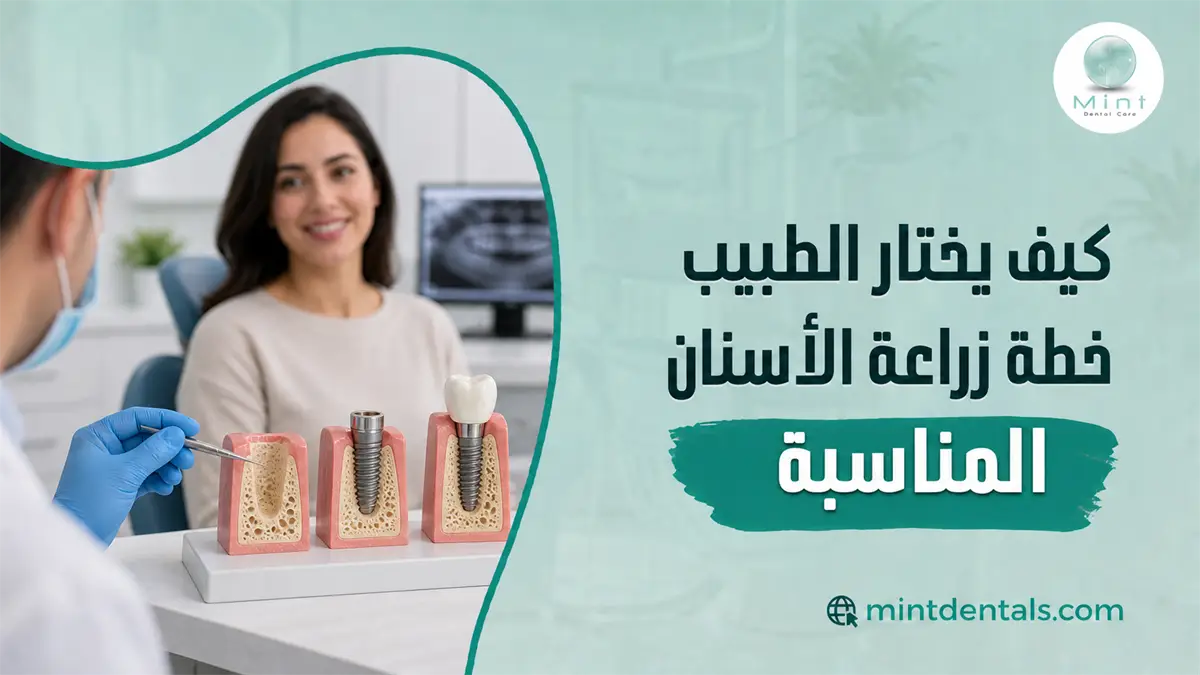 طبيب أسنان يشرح لمريضة خيارات زراعة الأسنان باستخدام نماذج للزرعات لتحديد خطة العلاج المناسبة.