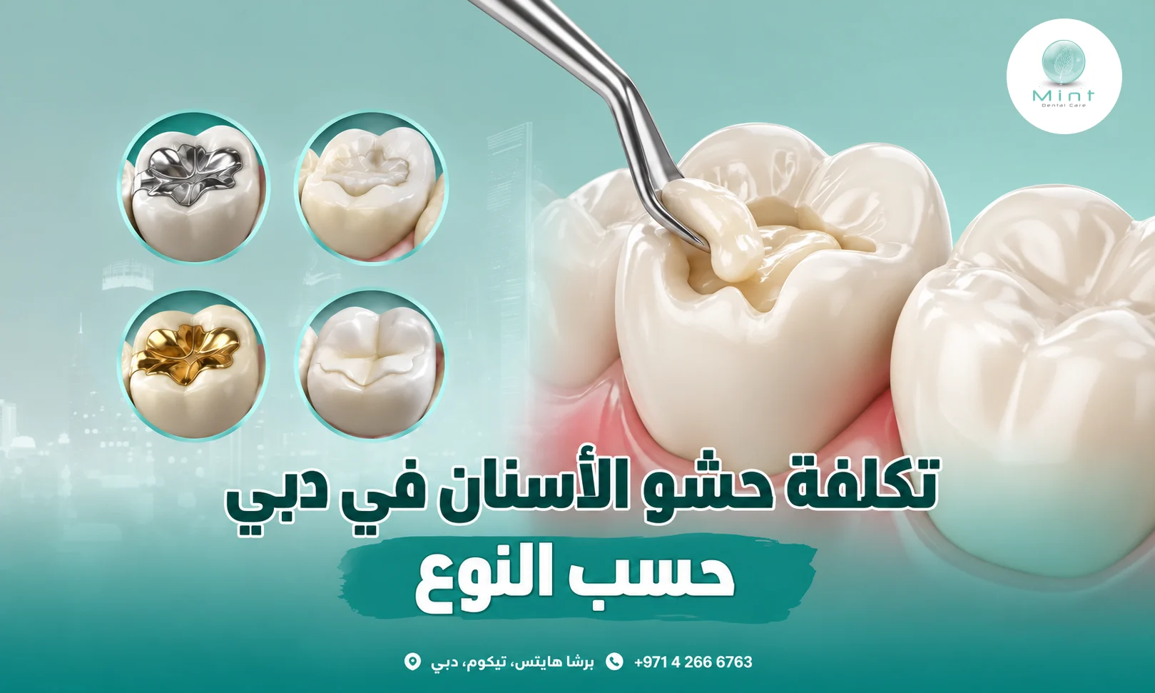 تكلفة حشو الأسنان في دبي حسب النوع
