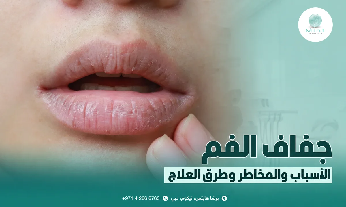 جفاف الفم: الأسباب والمخاطر وطرق العلاج