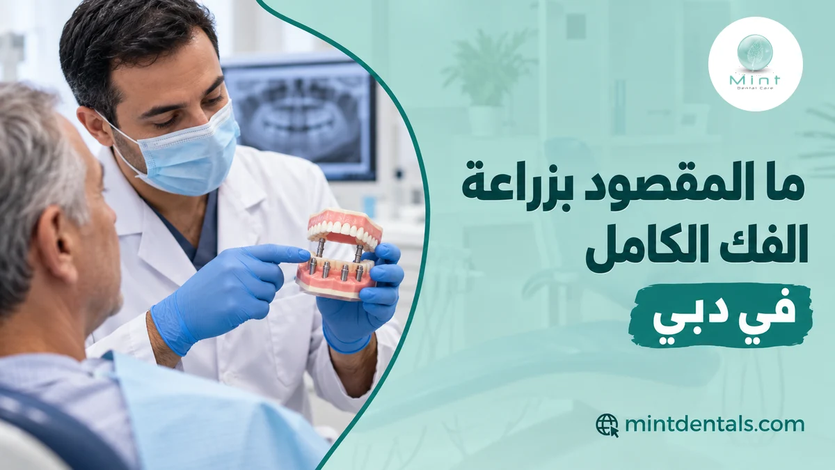 ما المقصود بزراعة الفك الكامل في دبي