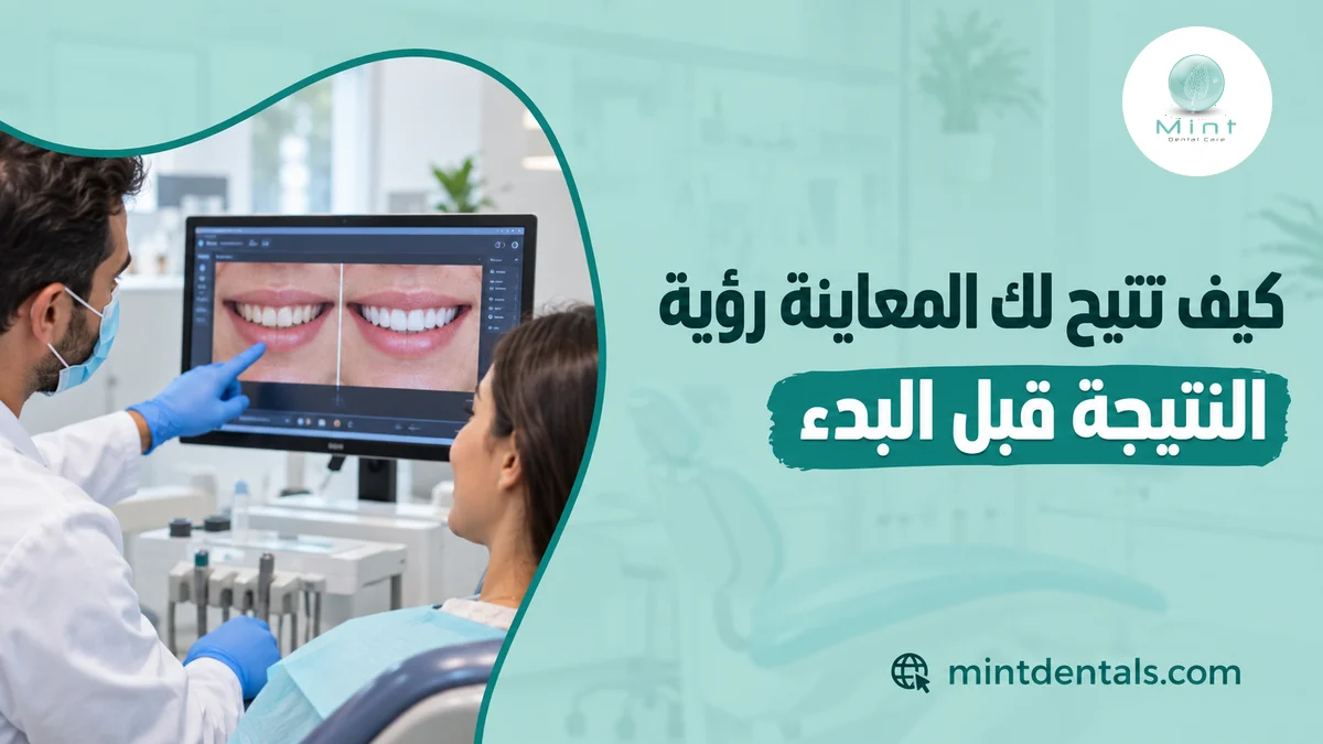 كيف تتيح لك المعاينة رؤية النتيجة قبل البدء