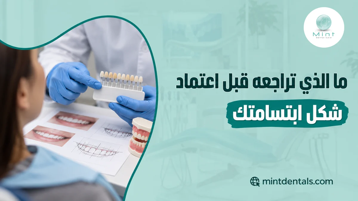 ما الذي تراجعه قبل اعتماد شكل ابتسامتك