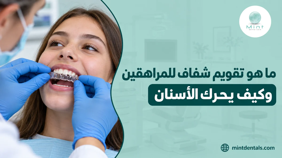 ما هو تقويم شفاف للمراهقين وكيف يحرك الأسنان